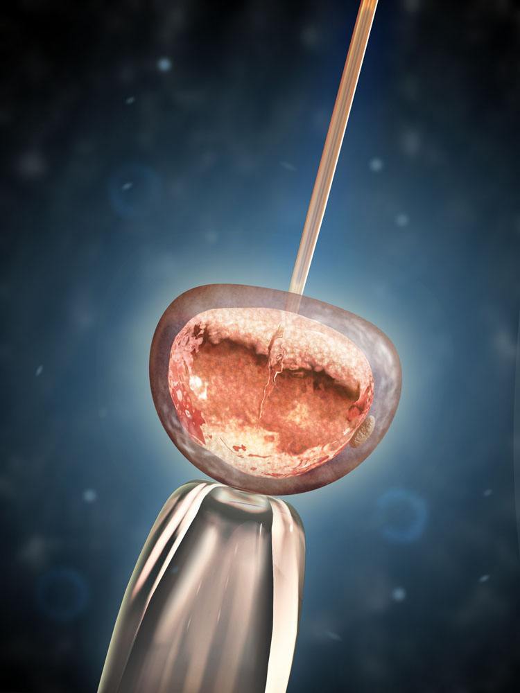 上海三代试管费用